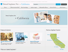 Tablet Screenshot of ca-dental-implants.net